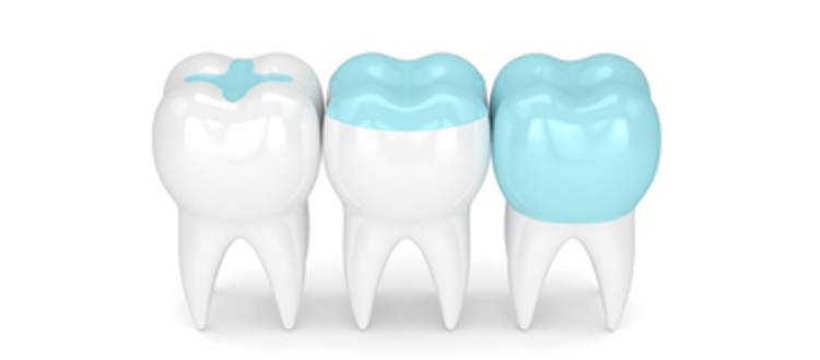 iSmile-restore iSmile-restore